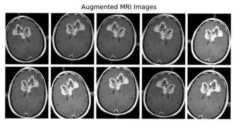 Brain Tumor Classification In Mri Image Using Convolutional Neural