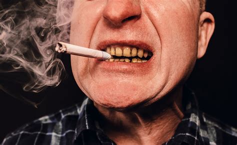 how does smoking affect my oral health