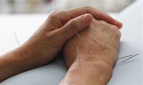 Should You Try Group Acupuncture