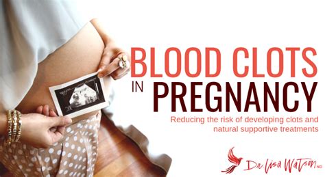 Blood Clots In Pregnancy Dr Lisa Watson