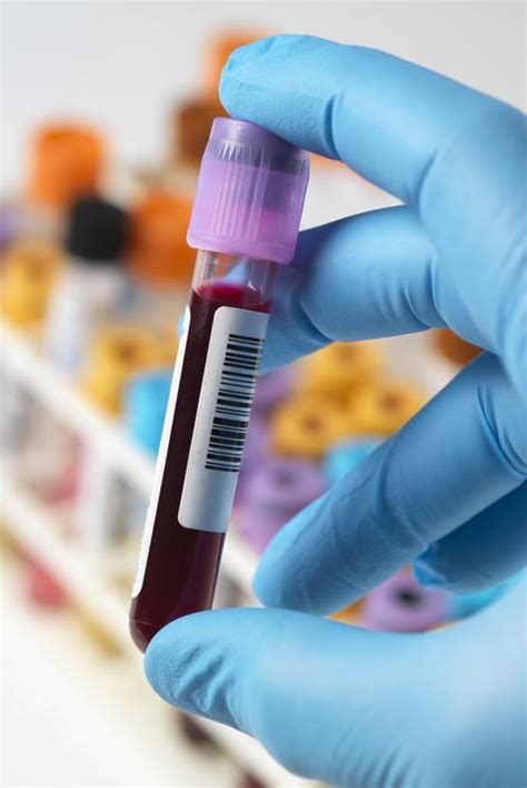 Jul 16, 2017 · if your tattoo was applied in one of the 11 states that do not regulate tattoo facilities, you must wait 3 months before donating blood. 15 Blood Donation Facts - How to Give Blood