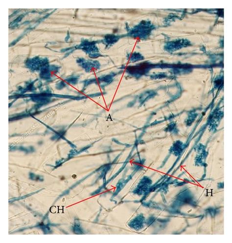 Illustration Of Different Arbuscular Mycorrhizal Fungi Colonization In