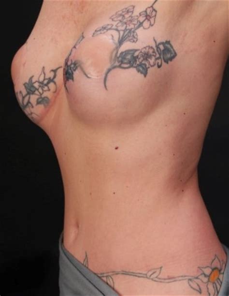 See more ideas about tattoos, cancer tattoos, breast cancer tattoos. Breast cancer tattoos: a debate