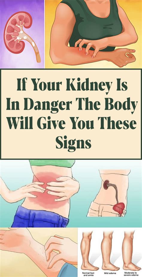 The kidneys sit in close proximity to many other abdominal structures which are important to be aware of clinically Pin on Health
