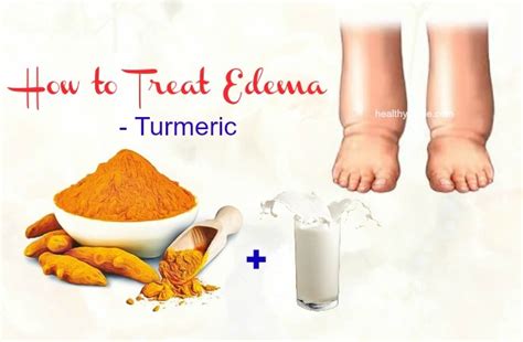 27 Tips How To Treat Edema In Face Hands Arms Feet Legs And Knee