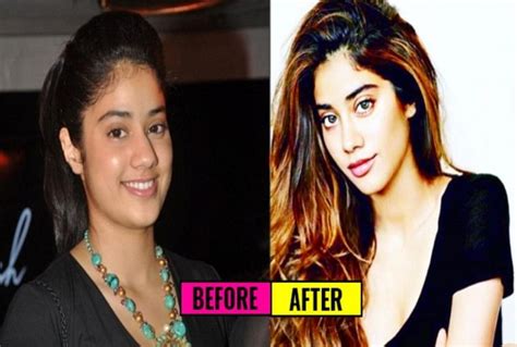 List Of Bollywood Actresses Who Have Had Plastic Surgery Amar Ujala