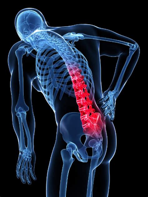 What Is Back Pain Types Symptoms Causes Diagnosis And Treatments