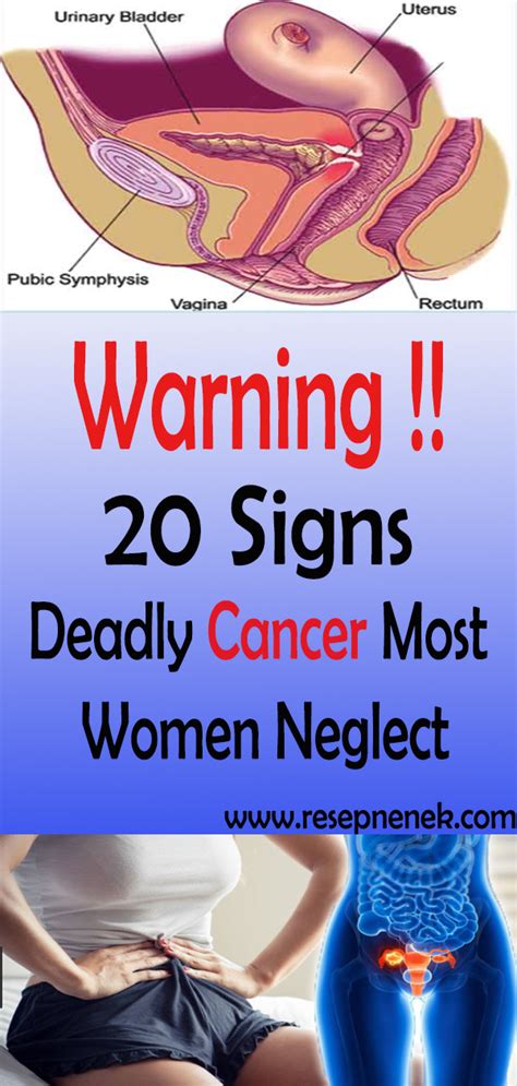 20 Deadly Cancer Signs Most Women Neglect Id Newstimes