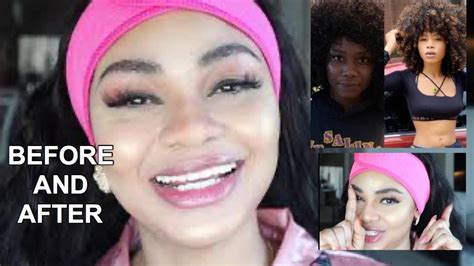 SKIN BLEACHING BEFORE AFTER OF SKIN WHITENING AND THE PRODUCTS USED YouTube