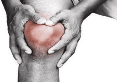 Early Symptoms Of Knee Arthritis Midwest Center For Joint Replacement Hip And Knee Replacement