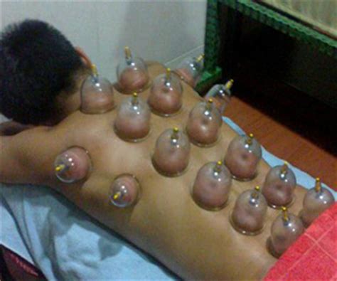 Cupping massage is another form of cupping therapy, which is commonly practiced in traditional chinese medicine. *Video* Super Secret Chinese Suction Cup Therapy Used To ...