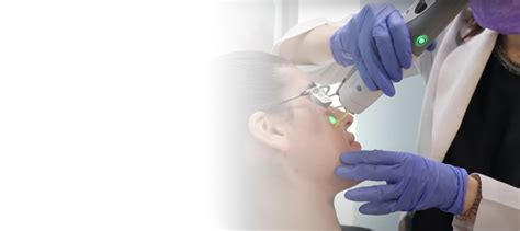 Acne Treatment Dermatology Experts San Diego Ca Clderm