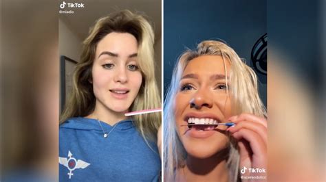 Tiktok Users Dentists Warn Others Not To Join Teeth Filing Trend The