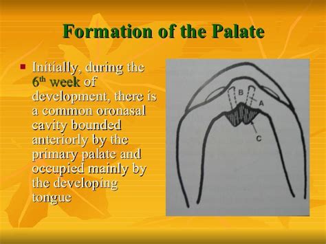Formation Of The Palate
