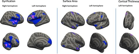 Association Between Autistic Traits And Surface Based Mri Brain