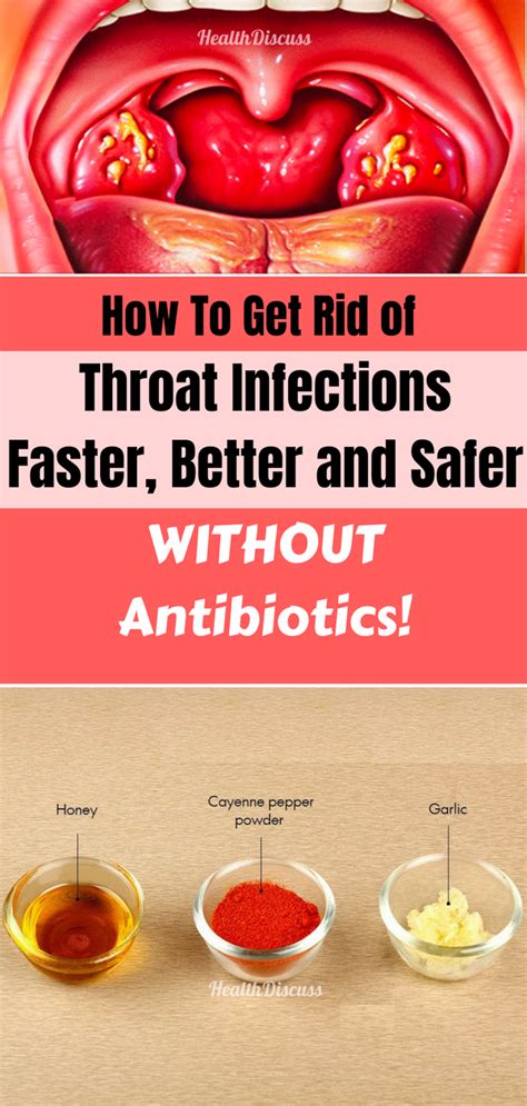 How To Get Rid Of Throat Infections Faster Better And Safer Without