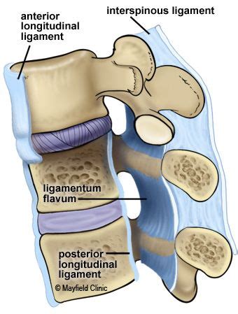 Thoracic myelopathy caused by ossification of ligamentum flavum of which fluorosis as an etiology factor. Figure 7 The ligamentum flavum, anterior longitudinal ...