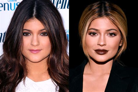 Of The Most Drastic Celebrity Plastic Surgeries