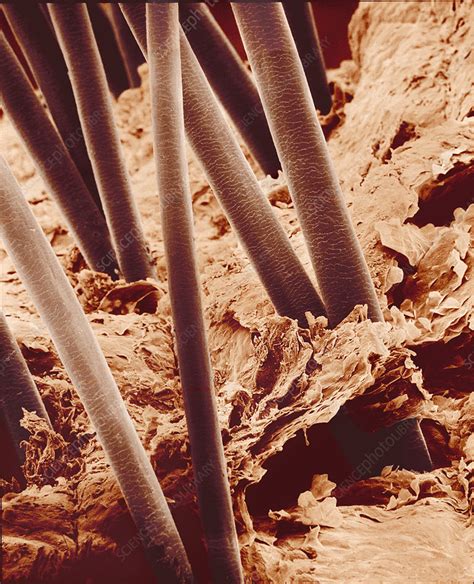 Human Hair Sem Stock Image P7200240 Science Photo Library