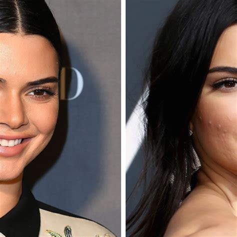 did kendall jenner get lip injections kendall jenner s lips at the 2018 golden globes marie