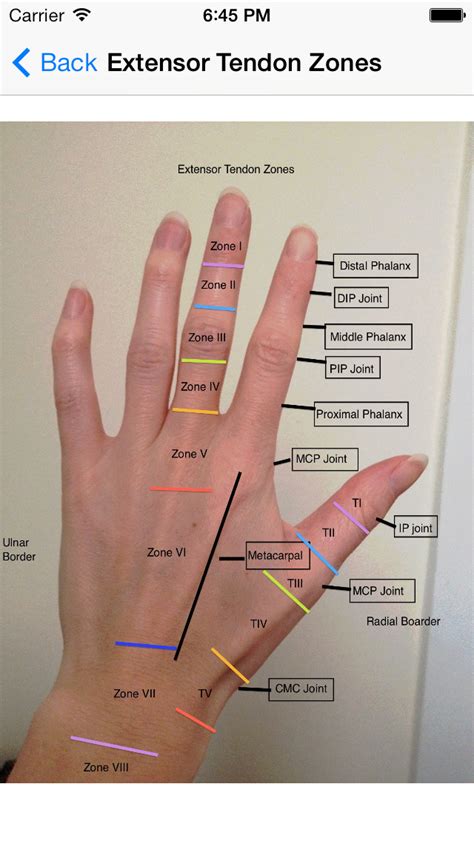 Icd 10 Code For Wrist Extensor Tendonitis