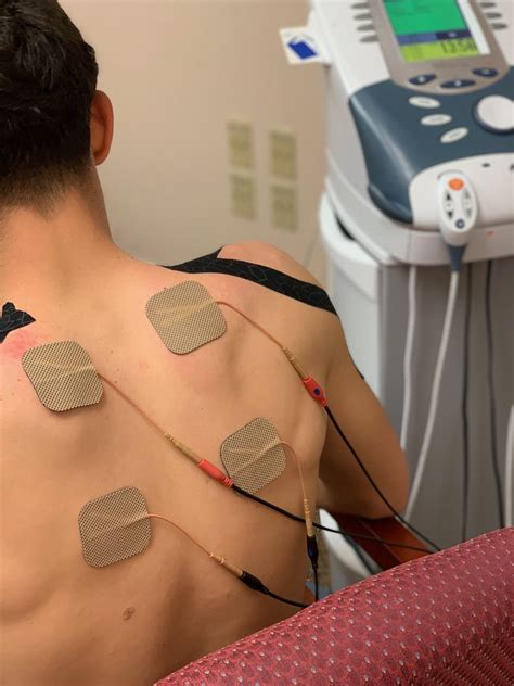 Electrical Stimulation Healing Star Physical Therapy And Wellness