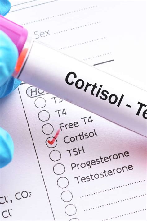 Cortisol level test: Purpose, procedure, and results