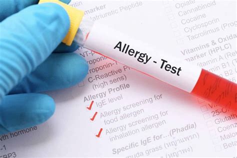 Tes Alergi Apa Saja Jenis Dan Bagaimana Prosedurnya Lifepackid