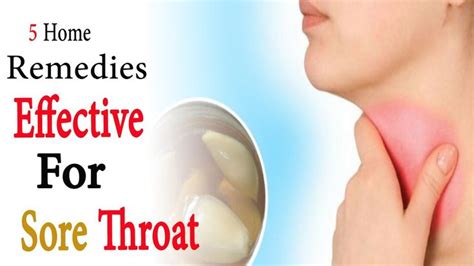 Cold Sore Throat Five Home Remedies For Sores Throat Cold Sore