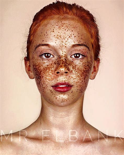 Brock Elbankunique Beauty Of Freckled People Series Elise Clement