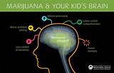 Marijuana On The Teenage Brain Images