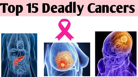 Top 15 Deadly Cancers Top Killing Cancers On Earth Deaths Due To