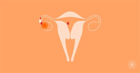 Ovulation Bleeding And Ovulation Spotting What It Is And Why It Happens