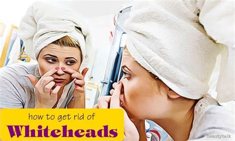 10 Proven Ways How To Get Rid Of Whiteheads Effectively