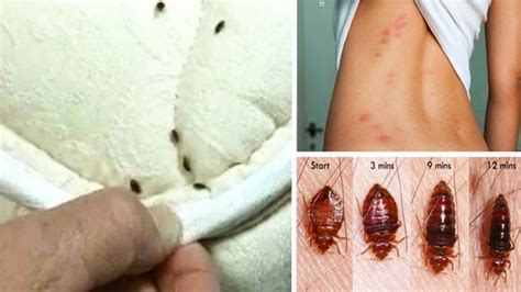How to tell if you have bed bugs in your mattress. Kill Bed Bugs - All the Pest Information You Need