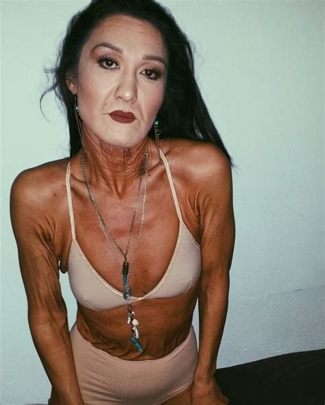 Brave 26 Year Old Woman With Rare Skin Condition That Makes Her Look Decades Older Launches