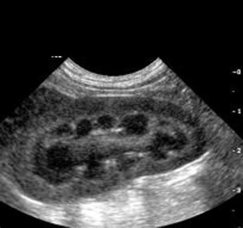 Nicknamed the windy city, it is a vibrant city that sits on lake michigan's shore and is recognized as a thriving multicultural center. Animal Ultrasound Services Clinic Chicago