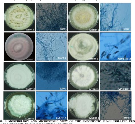 Figure 1 From Isolation And Identification Of Endophytic Fungi With