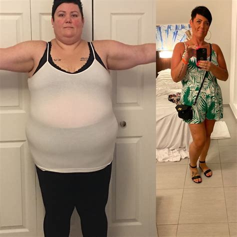 Sarah Loses Over 100 Pounds With Her Gastric Sleeve Smartshape Weight Loss Centre