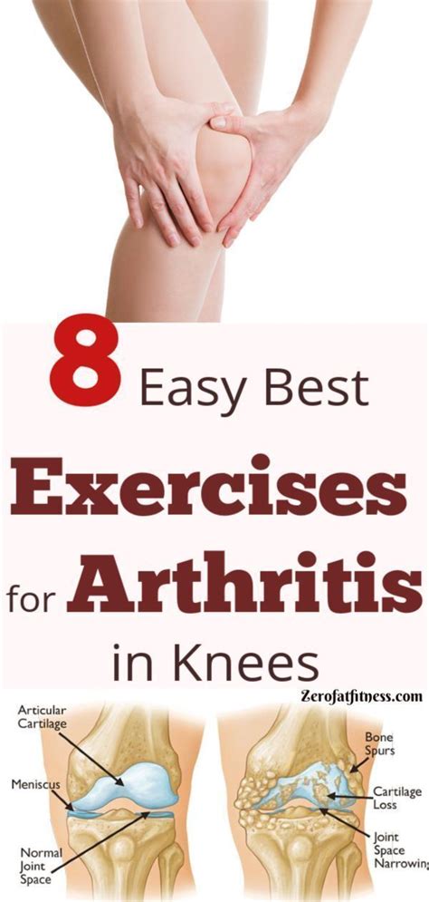Pain Relief Remedies 8 Easy Best Exercises For Arthritis In Knees Try These Physiotherapy