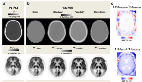 Fdg Brain Pet Image Reconstruction And Postprocessing A Petct