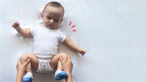 Hip Dysplasia Pada Bayi Baru Lahir Ketahui Penyebab Dan Cirinya Orami