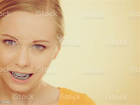 Woman Showing Her Teeth With Braces Stock Photo Download Image Now