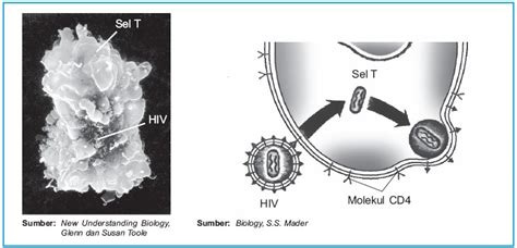 Pilih & download gratis 700 contoh gambar orang sakit beresolusi tinggi. Penyakit HIV AIDS : Pengertian Penyebab Penularan Pencegahan