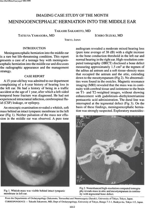 Meningoencephalic Herniation Into The Middle Ear Takashi Sakamoto