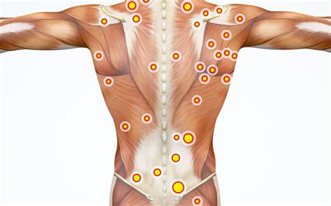 Trigger Point Massage Why Its Different Massage Therapy Concepts