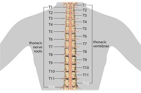 T12 Vertebral Fracture