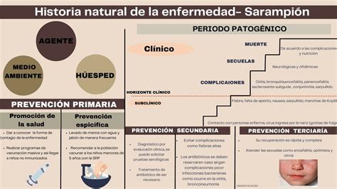Historia natural de la enfermedad Sarampión SAMANTHA MELISSA MORA