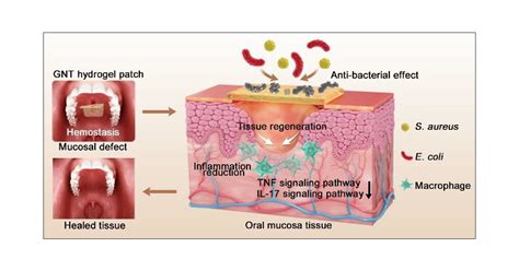 Low Swelling Adhesive Hydrogel With Rapid Hemostasis And Potent Anti