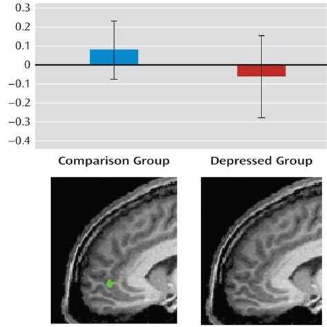 Depression Severity And Attachment In Relation To Amygdala Activity In